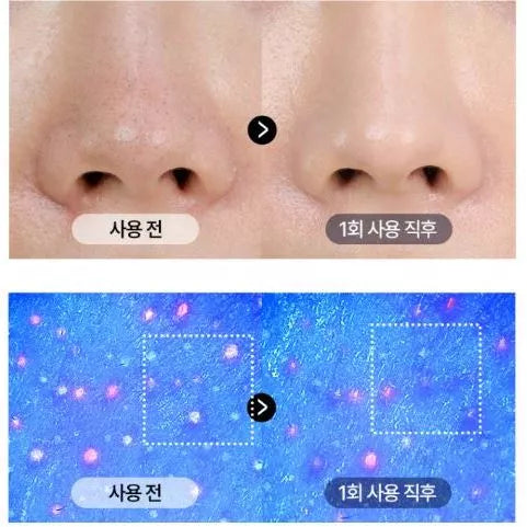 MediPeel Extra Super 9 Plus 2.0 Blackhead Care Solution