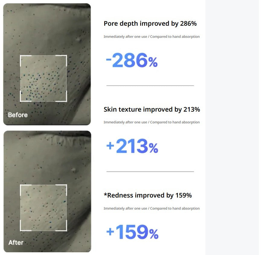 [MEDICUBE] AGE-R Mini Booster Pro | Portable Glow Booster | Spot Care (White/Baby Pink)