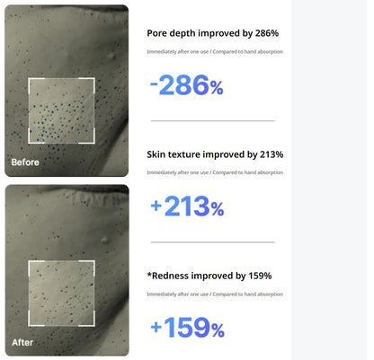 [MEDICUBE] AGE-R Mini Booster Pro | Portable Glow Booster | Spot Care (White/Baby Pink)